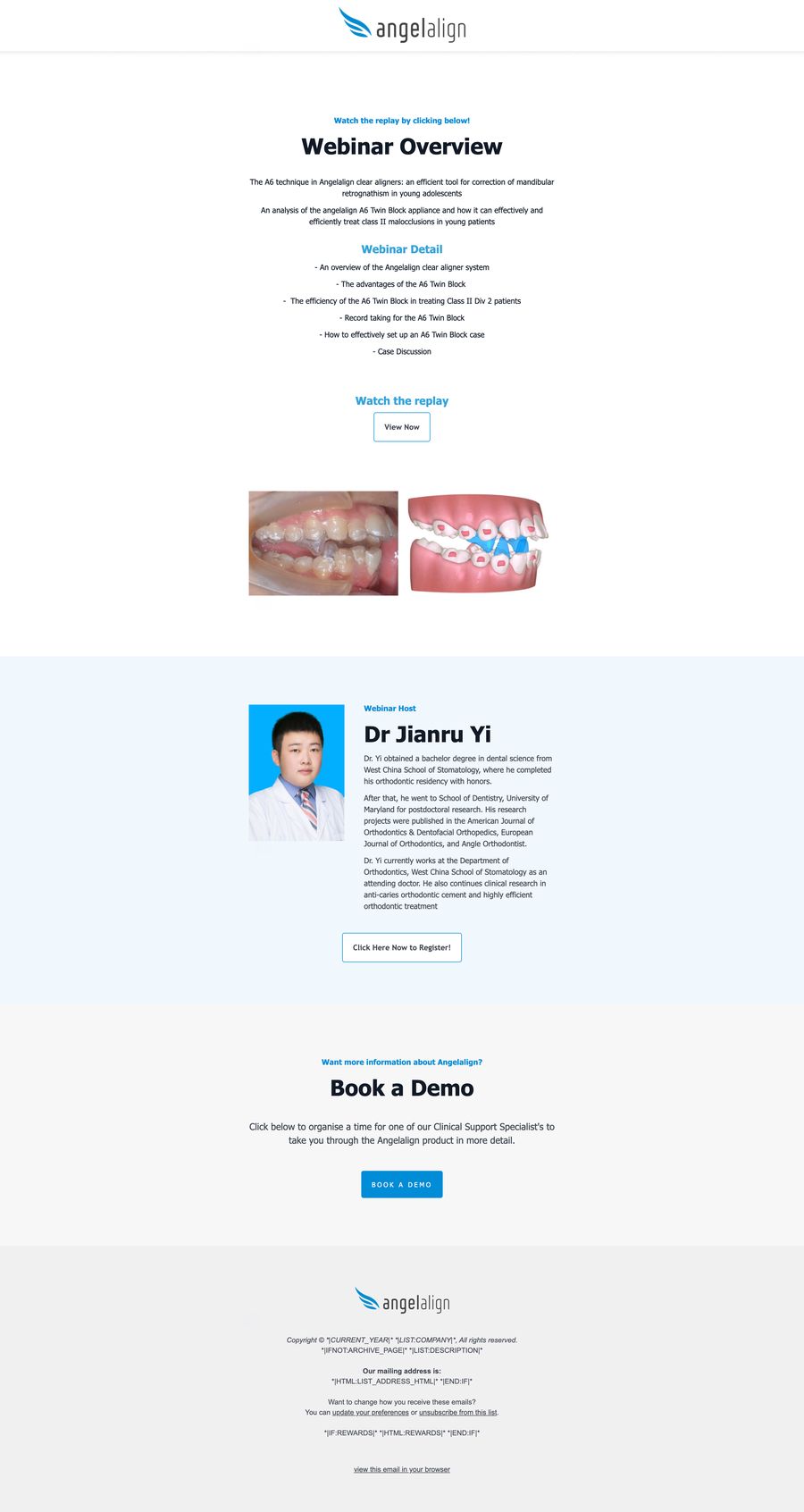 Angel Align email template detail
